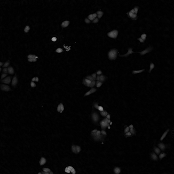 Image of cells on a microscope